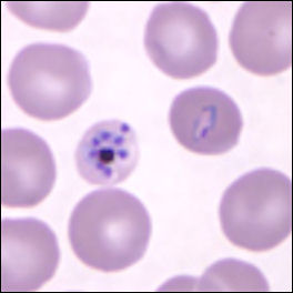 20110306-malaria cdc  knowlesi.jpg